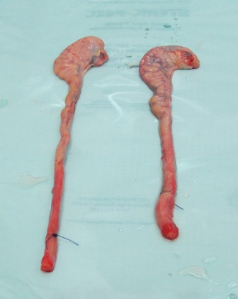 Epididymides