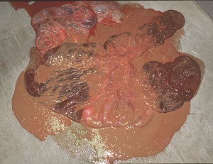 What Can Cause a Mare_Nocardioform placentitis with mucoid exudate