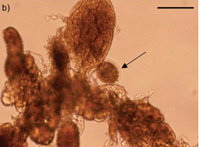 Subfertility_Uterine cells-Oocyte recovered